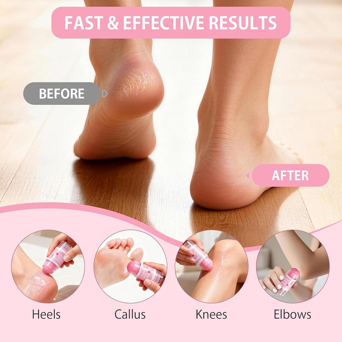 Silicone Moisturizing Socks with Urea Foot Cream for Dry Cracked Feet Women | 2 in 1 Gel Socks & Foot Cream for Dry Feet, Foot Care Moisturizing Socks with Vitamin E, Olive, Jojoba, Rose Oil (Pink)